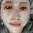 바로그의원 | [바로그의원 거제점] 시그니처 올인원 2회차 | 토닝, 엔디야그, 엑셀V 후기