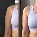 멍케어 | 팔뚝 부자 탈출기 2 (팔뚝 람스 일주일 후기, 멍, 붓기, 오렌지 케어)