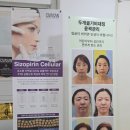 센텀시티 피부관리 추천, 샤넬관리 솔직후기 청담민에스테틱