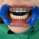 그랑치과교정과치과의원 | 교정치과 추천 서울대입구역 그랑교정치과 교정상담비용 후기!