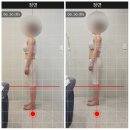 일산체형교정 마두역 더나은체형교정원 산후 붓기 통증관리
