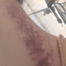 일성목욕탕 | 부산 피부관리 리하에스테틱 하이푸 리프팅 후기