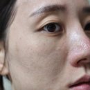 에센시엘 포텐셀 뷰티디바이스 솔직후기 (포텐자 모공·결·흡수력 변화)