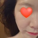 채운 | 청주수분관리 마리뷰티에서 수분가득 채운 후기