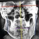 판교서울치과교정과치과의원 이미지