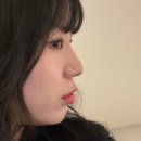 하이코코이비인후과의원 | 홍대 하이코ㅣ코필러 후기ㅣ홍대 피부과