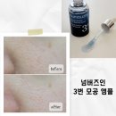 바이오 포스트 | 내돈내산) 넘버즈인 3번 블루 바이오 레티놀 모공 앰플 한달 사용 찐 후기 효과는?