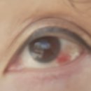 고양성모안과의원 이미지