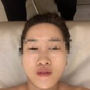 [마포피부관리] 리앤메이 뷰티 스튜디오 물방울 테라피 찐후기