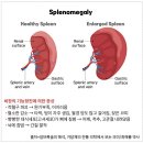 마른 기침 호소하는 환자에 &#39;자음강화탕(滋陰降火湯 이미지