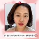 세탁종합병원 | 광주 운암동 피부관리 에스테틱오프 윤곽관리 내돈내산 후기