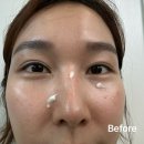 은삼성성형외과 네이버블로그