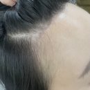 강남병원 | [강남 병원 후기] 리메이크 강남 탈모 진료 방문 후기