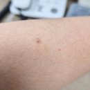 성인약품 | [한미약품]쎄코론지크림 (습진.가려움.아토피.건선)