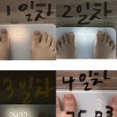 모로톡스 &#39;내돈내산&#39; 후기