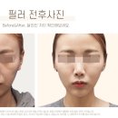 운정베스트의원 이미지