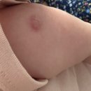 아이웰어린이병원 이미지