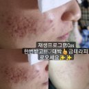 금테라피