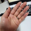 이유한의원 | 다한증 치료기 - 1탄 (치료결심한이유, 한의원치료,병원고르기,진단결과,진단후기)