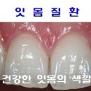 다시 쓴 (나만의 잇몸 치료법) 이미지