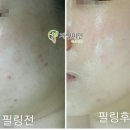 데코텍 이미지