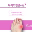면목동-206 네이버블로그