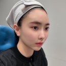 데이원의원 | 써마액티브 효과 제대로 본 데이원의원 강남점 솔직후기