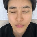 광리1 | 외대피부관리 노메러스킨 솔직 후기