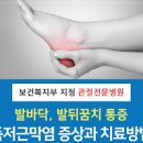 족저근막염 방법 발바닥통증 이외 증상 이미지