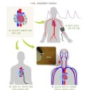 허혈성심장질환 분류표와 5대 심장질환 분류표의 비교 이미지