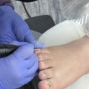 범서주유소 | 울산 발톱 무좀 치료 잘하는 곳ㅣ레푸스 울산범서점ㅣ독일식 문제성 손톱발톱 전문 케어