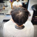 동탄 링거펌 찾는다면? 40대 남성탈모 수원 율전동 아엠헤드 방문 후기