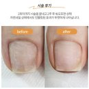 네일하는사이