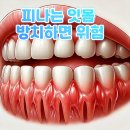 피가 나는 잇몸, 방치하면 위험해요! 건강한 치아 관리법 이미지