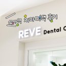 하얀제일부부치과의원 | 신사역 레브치과 내돈내신 치아미백 3회 솔직후기