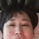 자연인한의원 | 이관장애 이관개방증.이관폐쇄증