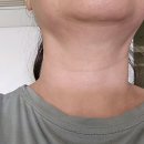 시온캐슬빌딩 | 명일역 피부과 전문 병원 후기 좋은곳 추천 6곳