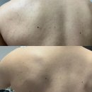 (주)유케이 | 여름 전 필수템 등드름없애는법 루틴, 유케이스크럽 일주일이상 사용후기