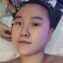 바디닥터수원장안대리점 | 부천피부관리 신중동역피부관리 닥터수 중동점 힐링 모공스파후기🛁