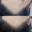 체인지헤어라인 이미지