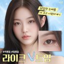 라이크성형외과의원 | 트임 성형 실패 후기, 왜 생길까?