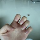 네일앤초이