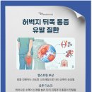 시원한마취통증의학과의원 | 허벅지 뒤쪽 당김 관련 질환과 통증 치료 방법은