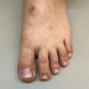 타임네일 페디베네 이미지