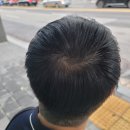 사당두피관리 혜민웨이 : 자연스럽게 남자 헤어라인 정수리 보강
