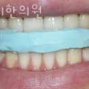 터커리한의원 네이버블로그