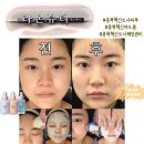 소로3-60(혁신도시) | 충북혁신도시웨딩관리 <라온뷰티> 물광피부 만든 찐 후기