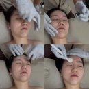 엘로우케어 | [UD블링]광주 쌍촌동 안티에이징 전문샵 비비에스테틱 트로이필후기