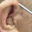 상무보청기 이미지