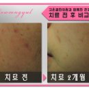 세유한의원 네이버블로그